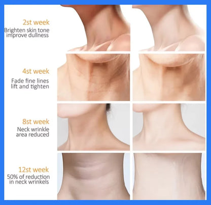 Collagen Neck Cream Eliminate Neck Wrinkle Lines Lifting Whitening Tighten Double Chin Anti-age Rejuvenation Skin Care Products