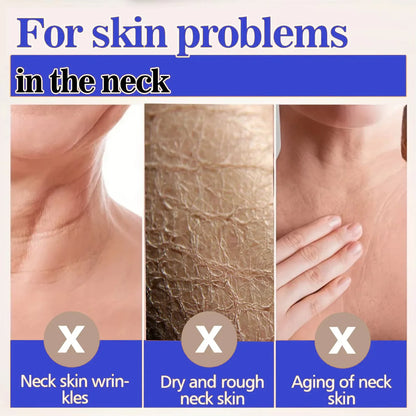 Collagen Neck Cream Eliminate Neck Wrinkle Lines Lifting Whitening Tighten Double Chin Anti-age Rejuvenation Skin Care Products
